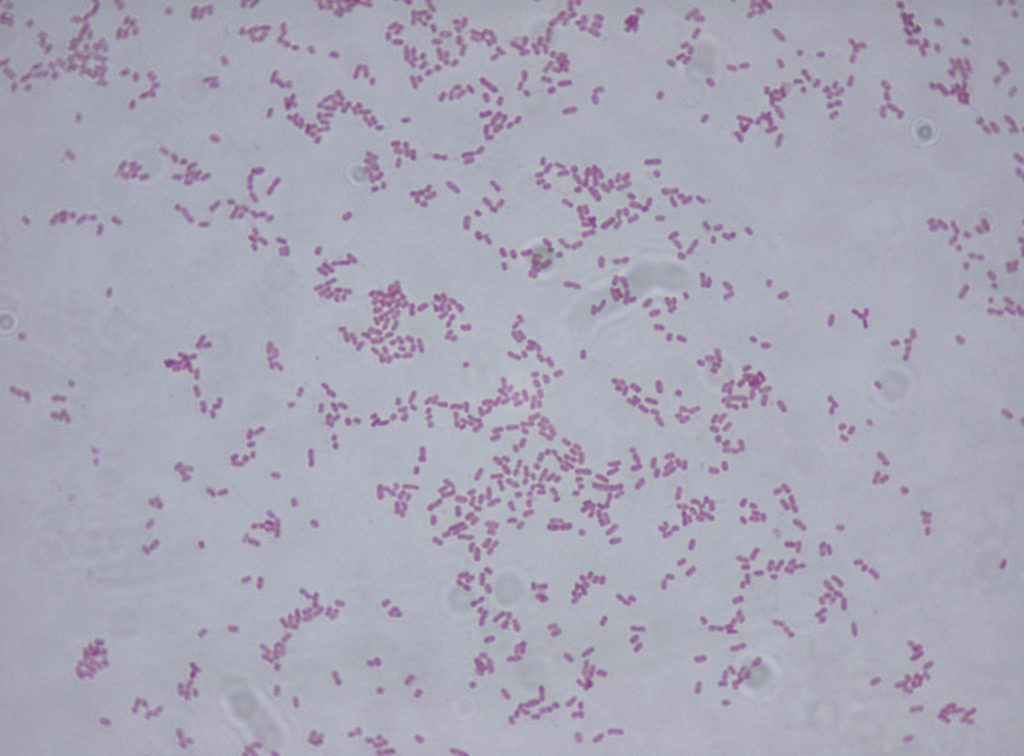 klebsiella oxytoca